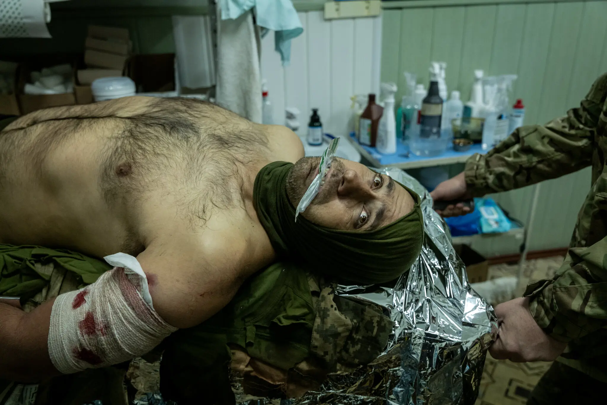 Українському військовому медики намагалися врятувати ногу. «Найважливіше в тих, хто кричить, це те, що вони дихають», — сказав один медик.